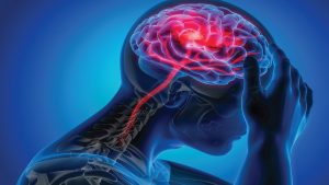 عوامل خطر سکته مغزی  - 1 2 300x169 - دلایل و عوامل خطر سکته مغزی