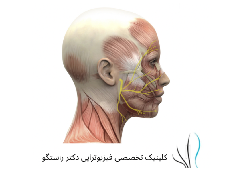 فیزیوتراپی فلج بلز - 2 - فیزیوتراپی فلج بلز