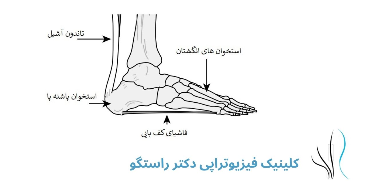 خار پاشنه چیست ورزش برای خار پاشنه - 1 1 - ورزش برای خار پاشنه