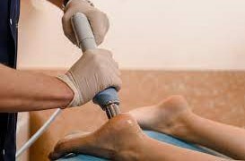 درمان خار پاشنه پا با شاک ویو درمان خار پاشنه پا با شاک ویو تراپی - 3 - درمان خار پاشنه پا با شاک ویو تراپی