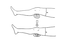 تمرین انقباض عضله چهارسر ران  - 5 - فیزیوتراپی بعد از تعویض مفصل ران