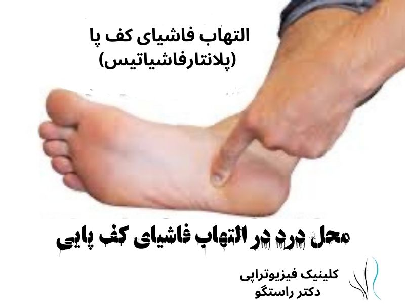 مقابله با آسیب های پای دوندگان: راهنمای پیشگیری و درمان - 33 - مقابله با آسیب های پای دوندگان: راهنمای پیشگیری و درمان